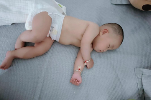 日土宝宝褶皱处擦粉还是油